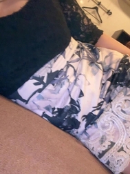 이어진 손바닥은 평생 붙은 채일까요?